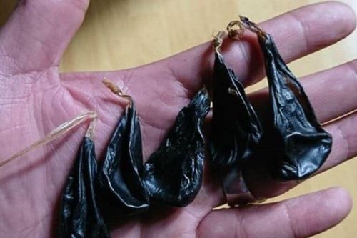 Uống mật khỉ phòng co giật, bé 9 ngày tuổi nguy kịch
