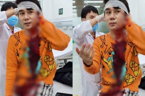 Nguyên nhân vụ nam diễn viên phim 'Thương ngày nắng về' bị chém giữa phố Hà Nội