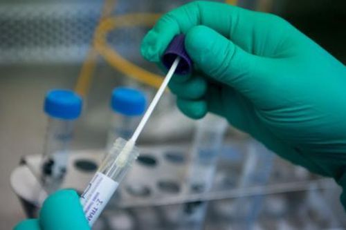 Thanh tra, xử nghiêm đầu cơ tăng giá kit test
