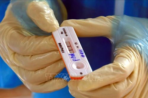Bộ Y tế trả lời về tình trạng khan hiếm và biến động giá kit test xét nghiệm SARS-CoV-2
