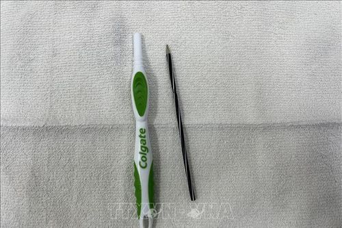 Phẫu thuật nội soi thành công cho bệnh nhân hai lần liên tiếp nuốt phải dị vật