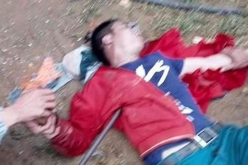 Rơi từ mái nhà, người đàn ông bị xà beng đâm xuyên ngực
