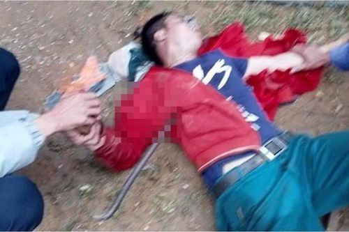 Người đàn ông bị xà beng đâm xuyên ngực khi rơi từ mái nhà xuống