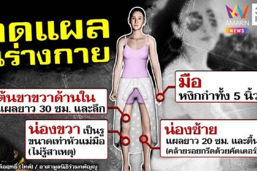 Công bố toàn bộ vết thương trên người diễn viên Chiếc Lá Cuốn Bay, hé lộ một người có khả năng bị khởi tố