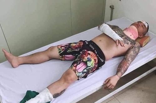 Sự thật thông tin 'thánh chửi' Dương Minh Tuyền bị đâm nhập viện