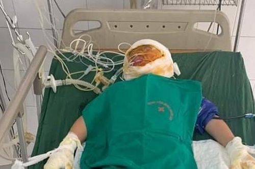 MS 739: Chập điện cháy nhà khiến ba anh em mồ côi người mất, người cấp cứu trong nguy kịch