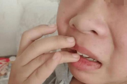 Nữ sinh lớp 8 bị thầy Hiệu phó tát liên tiếp 30 cái, dùng chân đạp vào người