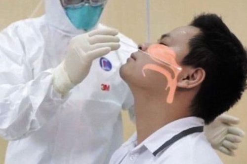 Chọc mũi test COVID-19 có sợ dễ bị viêm mũi, viêm xoang không? và đây là câu trả lời cụ thể
