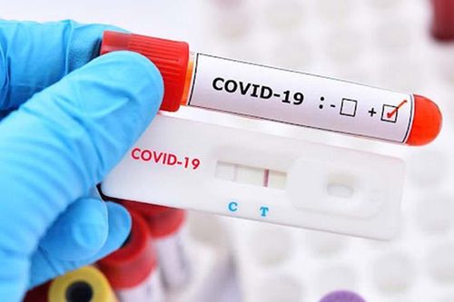 Khi nào mới cần test nhanh COVID-19?
