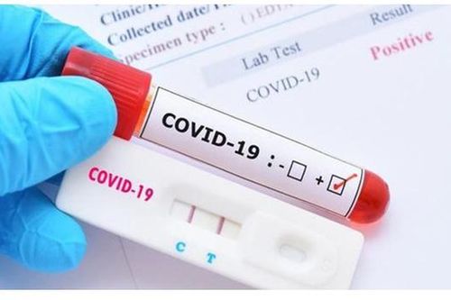 Hà Nội: Đẩy mạnh xử lý đầu cơ tăng giá vật tư điều trị Covid-19