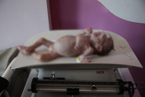 LHQ kêu gọi thế giới không lãng quên 19 triệu người đói nghèo ở Yemen