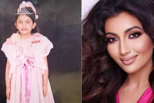 Tiết lộ bất ngờ về Á hậu 1 Miss World 2021: Từng gặp tai nạn đến biến dạng mặt