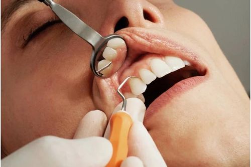 Nha sĩ cố tình làm gãy răng của bệnh nhân để kiếm tiền điều trị