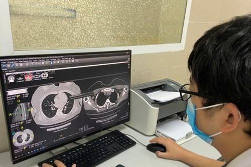 Chuyên gia chỉ cách điều trị các triệu chứng hậu COVID-19 thường gặp