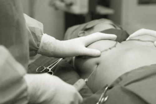 Những biến chứng có thể gặp khi phẫu thuật nâng ngực