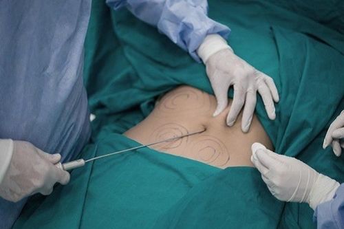 Hồi chuông cảnh tỉnh sau những 'sự cố y khoa' do phẫu thuật thẩm mỹ