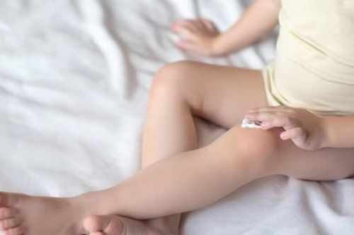 Trị viêm da cơ địa an toàn cho trẻ nhỏ