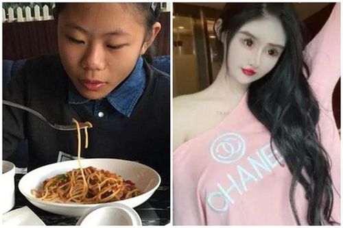 'Hot girl mặt rắn' và bi kịch 100 lần dao kéo vì ngoại hình