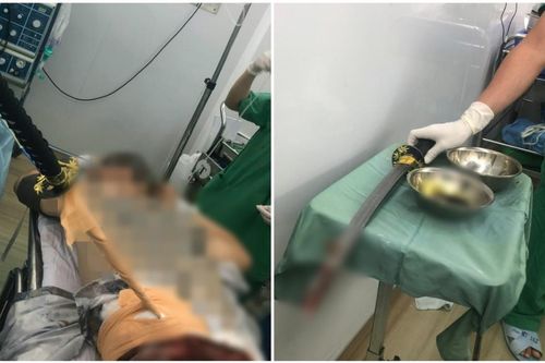 Cứu sống nam thanh niên nhập viện với thanh kiếm đâm xuyên thắt lưng