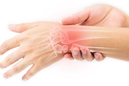 Hội chứng ống cổ tay ở nhân viên văn phòng là gì?