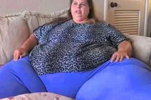 Người phụ nữ béo nhất hành tinh nặng 302kg chỉ có thể đi lại bằng xe đẩy 'biến hình' sốc sau 10 năm, không nói không ai dám tin là 1 người