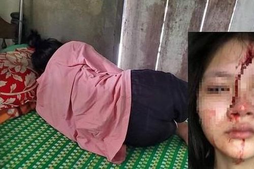 Nhiều vụ học sinh đánh nhau, ngành giáo dục 'chẩn bệnh' bạo lực học đường