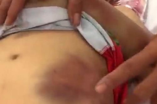 Điều tra vụ bé gái 7 tuổi tử vong bất thường ở huyện Củ Chi