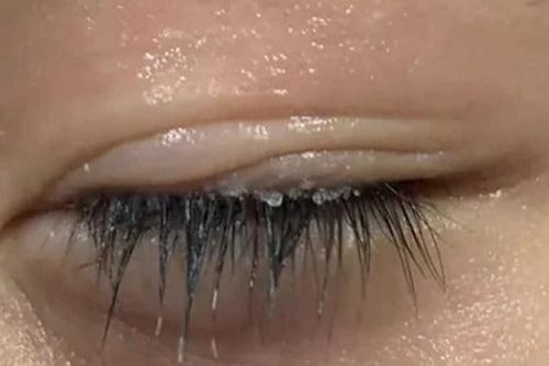 Mẹ làm điều này với con trai, bác sĩ quát to: Suýt thì mù