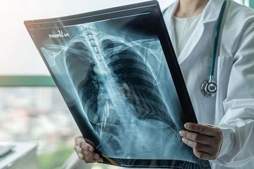 4 nhóm người có nguy cơ bị xơ phổi hậu COVID-19, có dấu hiệu này cần đi khám sớm!