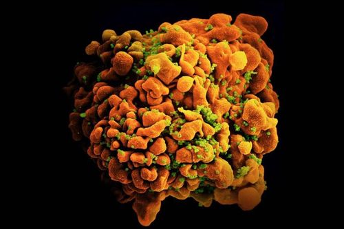 Hy vọng mới cho vaccine HIV