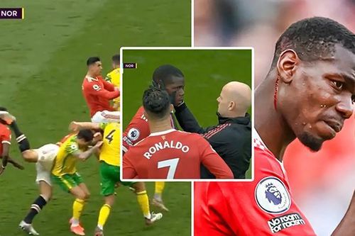 Pogba giận tím người vì lãnh trọn gầm giày của Maguire vào mặt