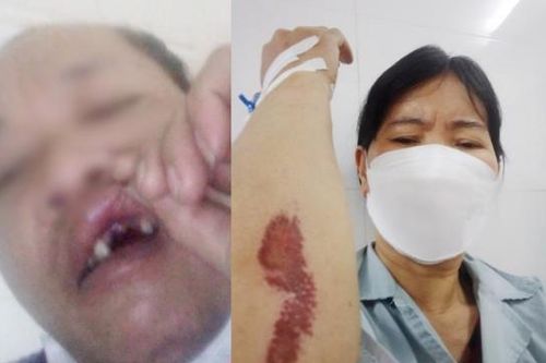 Nhóm côn đồ hành hung cụm phó dân cư xã nhập viện ở Đan Phượng