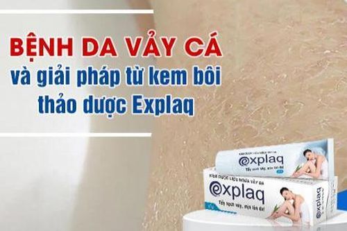 Bệnh da vảy cá và giải pháp từ kem bôi thảo dược Explaq