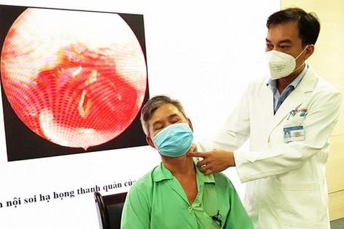 Giật mình khi ăn cá, người đàn ông bị xương ghim vào dây thanh quản