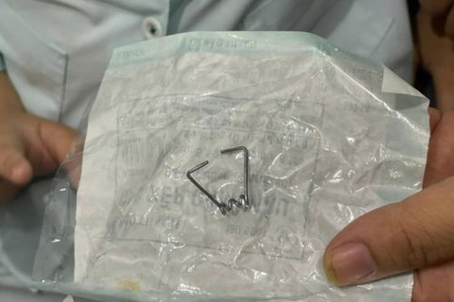Cấp cứu bé trai 9 tuổi mắc bệnh tự kỷ nuốt lò xo vào cổ họng