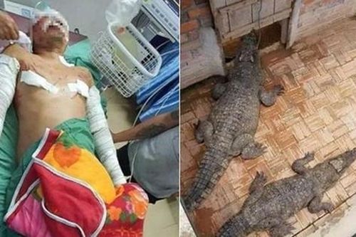 Đi vệ sinh gần ao, người đàn ông bị cá sấu cắn suýt chết