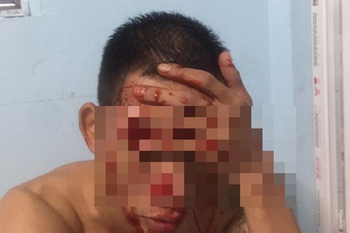 Dựng kịch bị bắt cóc để tống tiền bố mẹ