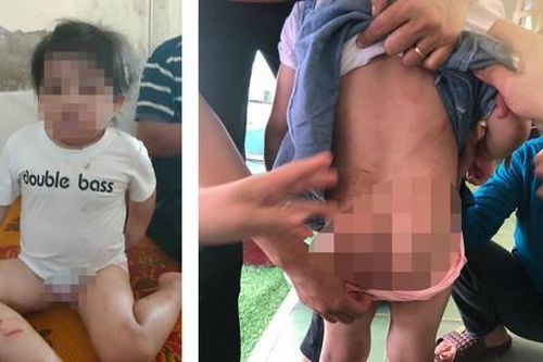 Bé gái 4 tuổi tại Hà Tĩnh bị bạo hành: Sự thật từ lời khai của dì ruột