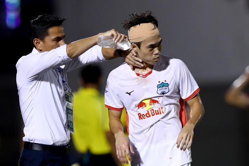 Văn Toàn đổ máu trong trận thua của HAGL