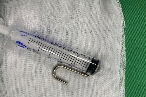 Móc khóa sắt nằm trong dạ dày bé 20 tháng tuổi