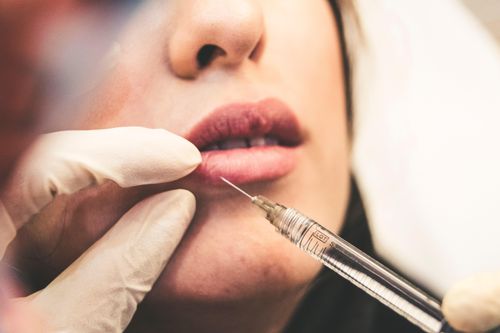 Mất thị lực sau tiêm filler làm đầy rãnh má tại tiệm tóc