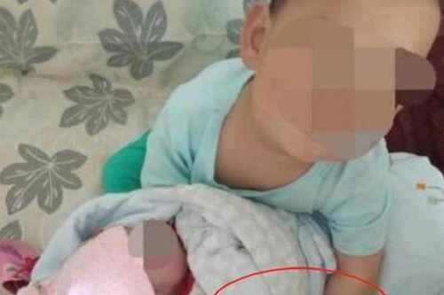 Bé gái sơ sinh luôn khóc toáng mỗi khi anh trai lại gần, sự thật phía sau khiến người mẹ 'gục ngã'