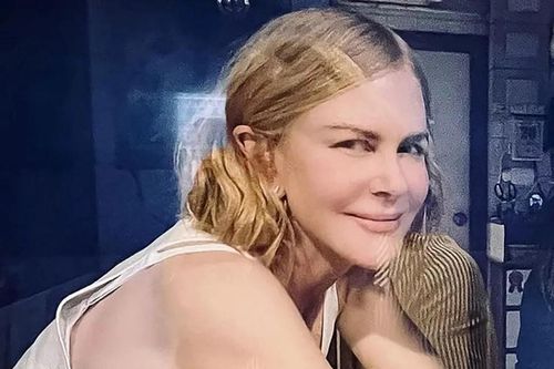Bức ảnh gây tranh cãi của Nicole Kidman