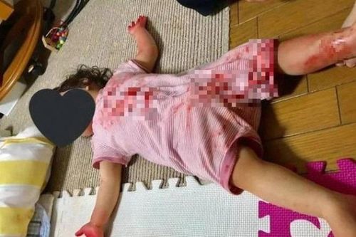 Người con gái dính đầy vết đỏ như máu, sự thật ngỡ ngàng
