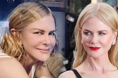 Nicole Kidman làm gì trên gương mặt không nếp nhăn ở tuổi U60?