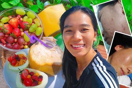 Người phụ nữ 'lột xác' sau 10 năm trị mụn vất vả cùng đủ thứ bệnh