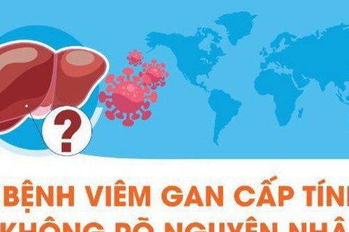 Bệnh viêm gan cấp tính không rõ nguyên nhân ở trẻ em