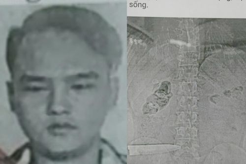 TP.HCM: Truy nã con riêng dùng dao đâm chết cha dượng