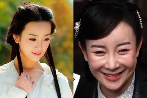 'Thần tiên tỷ tỷ' Cbiz mất cả sự nghiệp vì giật chồng, mặt biến dạng hậu dao kéo