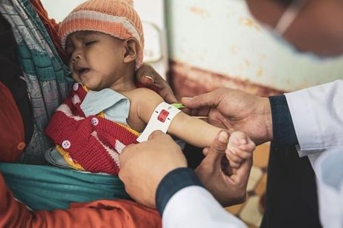 Đẩy mạnh nỗ lực đưa việc điều trị trẻ em suy dinh dưỡng cấp tính